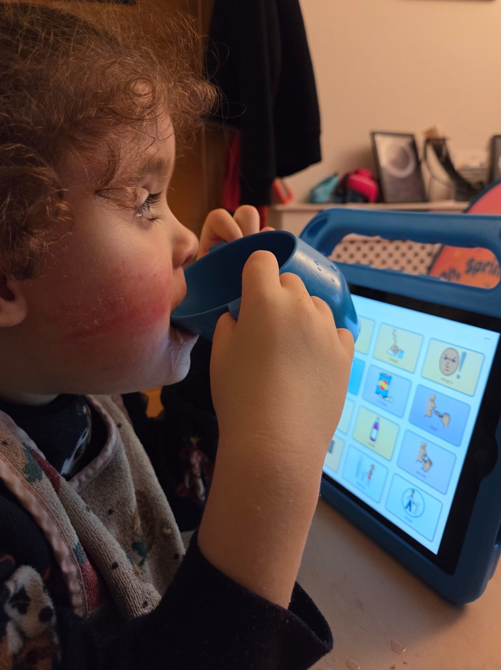 We just took out Poppy’s feeding&nbsp;tube!